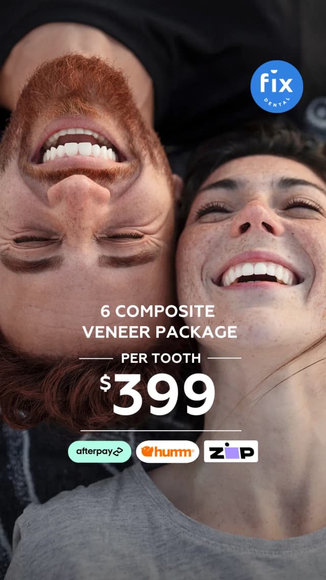 Composite Veneers 2 1080×9102